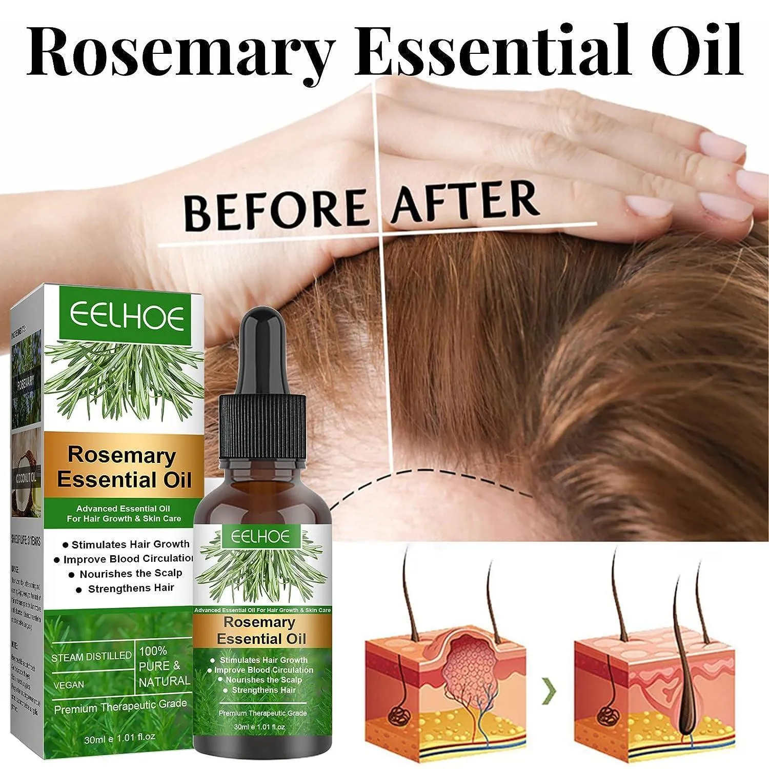 EELHOE Rosemary Oil for Hair Growth